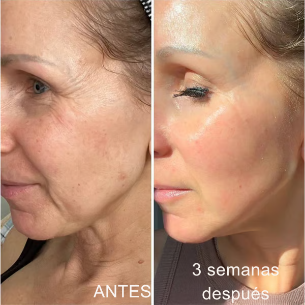 Oferta Especial 2x1: Celimax™ ¡Piel más firme y suave!