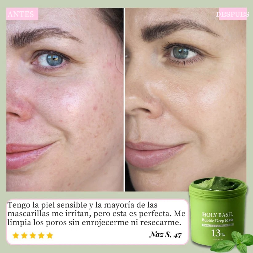 ¡Piel más limpia, purificada y sin puntos negros! Holy Brasil™