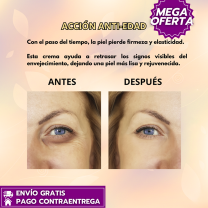 Oferta Especial 2x1: Mercilen EyeLift™ Contorno de ojos antiarrugas que reafirma, alisa e ilumina tu mirada.