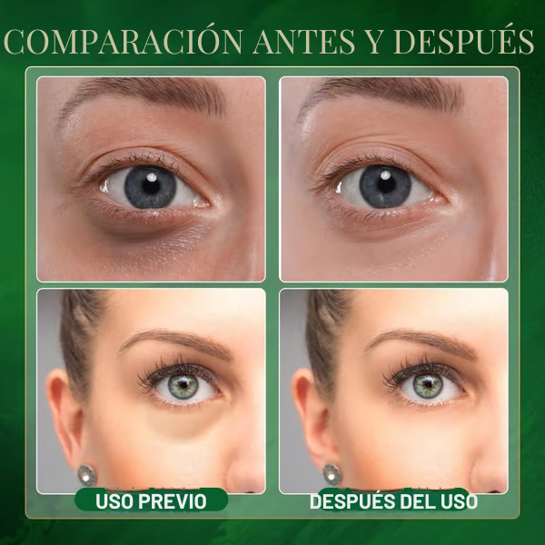 ¡Ojos más hidratados y rejuvenecidos! Máscara Suave Periocular Avocado Eye Mask™