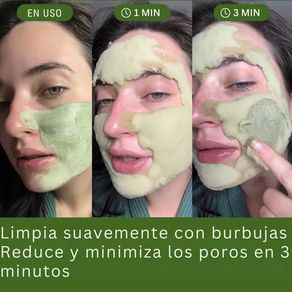 ¡Piel más limpia, purificada y sin puntos negros! Holy Brasil™